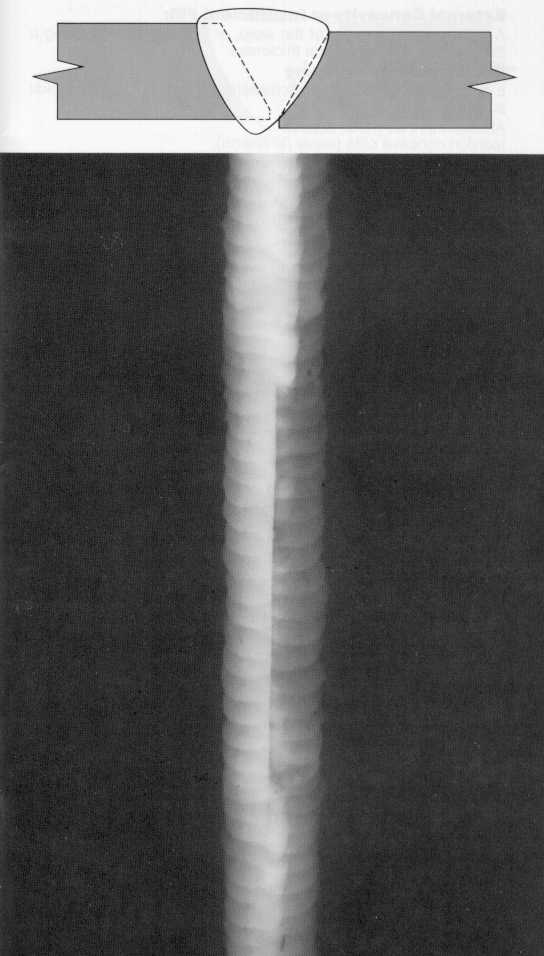 welld-02 (Incomplete Root Fusion������δ�ۺ�).jpg